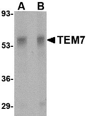 1 - TEM7 Antibody ASC10587