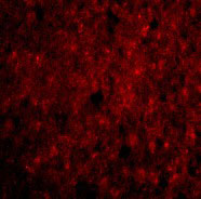 3 - CDNF Antibody ASC10588