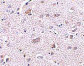 2 - CDNF Antibody ASC10588