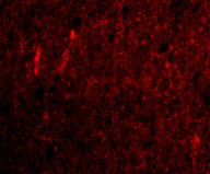 3 - CDNF Antibody ASC10589