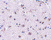 2 - CDNF Antibody ASC10589