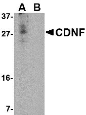 1 - CDNF Antibody ASC10589