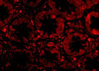 3 - TEM1 Antibody ASC10596