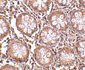 2 - TEM1 Antibody ASC10596