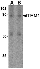1 - TEM1 Antibody ASC10596