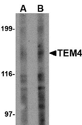 1 - TEM4 Antibody ASC10599
