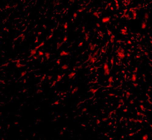3 - TEM5 Antibody ASC10601