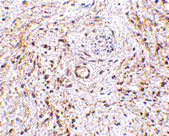 2 - TEM5 Antibody ASC10601