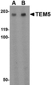 1 - TEM5 Antibody ASC10601