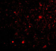 3 - TOCA-1 Antibody ASC10602