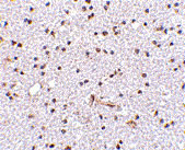 2 - TOCA-1 Antibody ASC10602