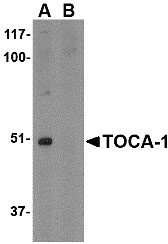 1 - TOCA-1 Antibody ASC10602