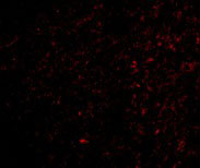 3 - TOCA-1 Antibody ASC10603