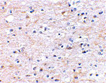 2 - TOCA-1 Antibody ASC10603