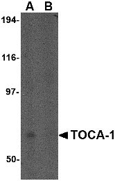 1 - TOCA-1 Antibody ASC10603