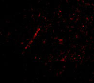 3 - Nhe-1 Antibody ASC10604