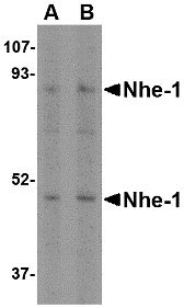 1 - Nhe-1 Antibody ASC10604