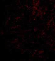3 - Nhe-1 Antibody ASC10605