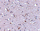 2 - Nhe-1 Antibody ASC10605