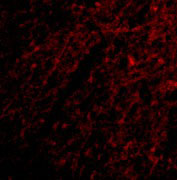 3 - Grik1 Antibody ASC10606