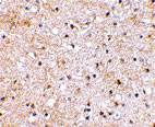 2 - Grik1 Antibody ASC10606