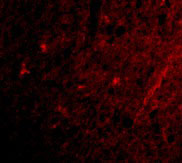 3 - Grik1 Antibody ASC10607