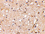 2 - Grik1 Antibody ASC10607