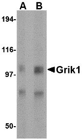 1 - Grik1 Antibody ASC10607