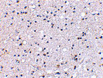 2 - Grik4 Antibody ASC10610