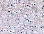 2 - Grik5 Antibody ASC10612