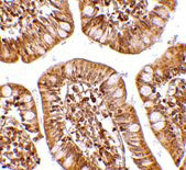 2 - ZBP1 Antibody ASC10614