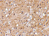2 - IPR1 Antibody ASC10617