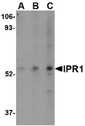 1 - IPR1 Antibody ASC10617