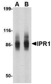 1 - IPR1 Antibody ASC10618