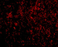 3 - ATG5 Antibody ASC10630