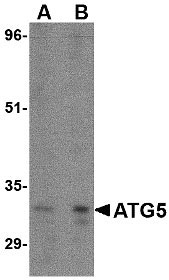 1 - ATG5 Antibody ASC10630