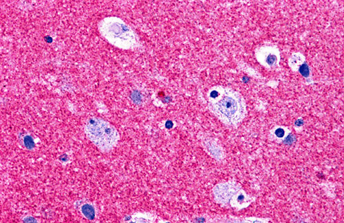 2 - RIM2 Antibody ASC10633