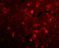 3 - Slitrk2 Antibody ASC10638