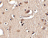 2 - Slitrk2 Antibody ASC10639