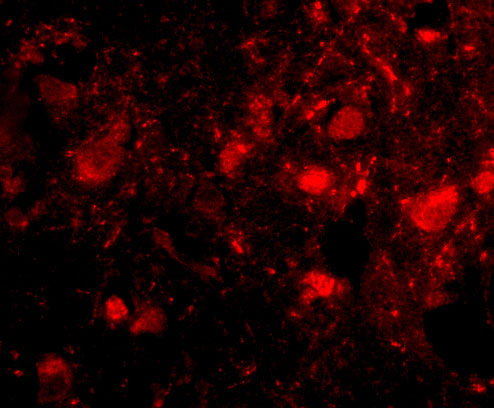 3 - Slitrk3 Antibody ASC10640