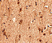 2 - Slitrk3 Antibody ASC10640