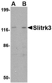 1 - Slitrk3 Antibody ASC10640