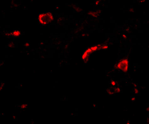 3 - Slitrk3 Antibody ASC10641