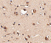 2 - Slitrk3 Antibody ASC10641