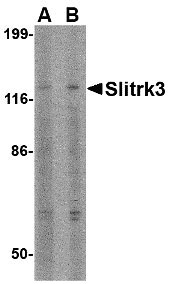 1 - Slitrk3 Antibody ASC10641