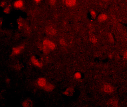 3 - Slitrk4 Antibody ASC10643