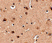 2 - Slitrk4 Antibody ASC10643