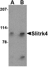 1 - Slitrk4 Antibody ASC10643