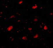 3 - Slitrk5 Antibody ASC10644