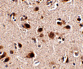 2 - Slitrk5 Antibody ASC10644